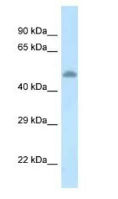 Western Blot: TAT Antibody [NBP1-79286]