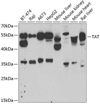 Western Blot: TAT AntibodyBSA Free [NBP2-95202]