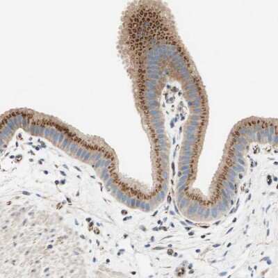 Immunohistochemistry-Paraffin: TATA Element Modulatory Factor 1 Antibody [NBP1-90117]