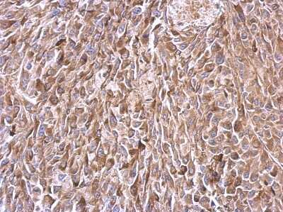 Immunohistochemistry-Paraffin: TATA Element Modulatory Factor 1 Antibody [NBP2-20572]