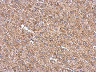 Immunohistochemistry-Paraffin: TATA Element Modulatory Factor 1 Antibody [NBP2-20572]