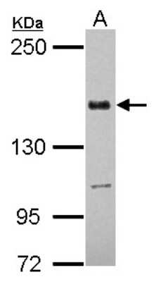 Western Blot: TATA Element Modulatory Factor 1 Antibody [NBP2-20572]