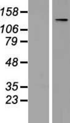 Western Blot: TATA Element Modulatory Factor 1 Overexpression Lysate [NBP2-10384]