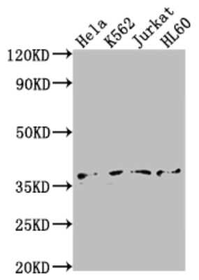 Western Blot: TATA binding protein TBP Antibody (3C7) [NBP3-15179]