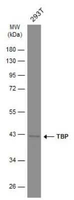 Western Blot: TATA binding protein TBP Antibody (GT453) [NBP3-13596]