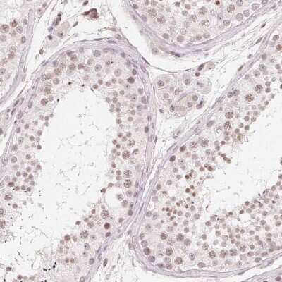Immunohistochemistry: TATA binding protein TBP Antibody [NBP2-38610]