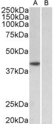 Western Blot: TATA binding protein TBP Antibody [NBP2-12933]