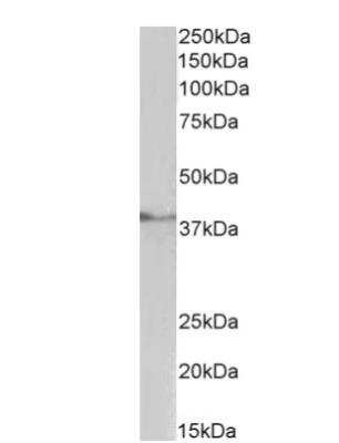 Western Blot: TATA binding protein TBP Antibody [NBP2-12933]