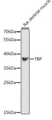 Western Blot: TATA binding protein TBP AntibodyBSA Free [NBP2-95183]