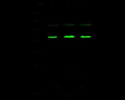 Western Blot: TATA binding protein TBP Antibody [NBP2-98905]