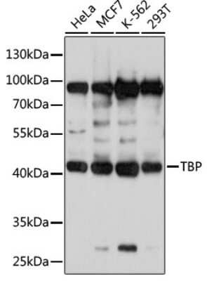 Western Blot: TATA binding protein TBP AntibodyBSA Free [NBP3-02958]