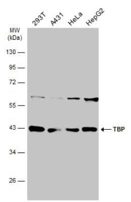 Western Blot: TATA binding protein TBP Antibody [NBP3-13174]