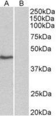 Western Blot: TATA binding protein TBP AntibodyIsoform 1 [NBP2-12932]