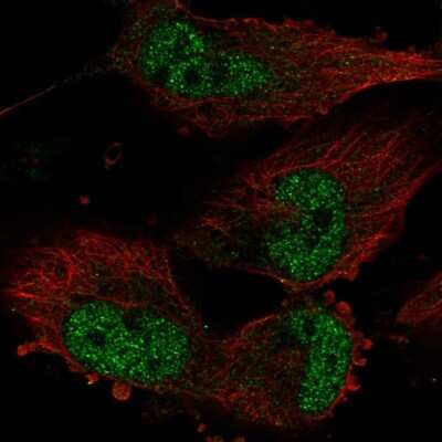 Immunocytochemistry/ Immunofluorescence: TATDN1 Antibody [NBP2-55666]
