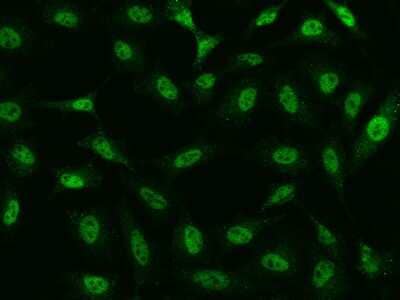 Immunocytochemistry/ Immunofluorescence: TATDN1 Antibody [NBP2-97967]