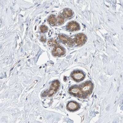 Immunohistochemistry-Paraffin: TATDN1 Antibody [NBP1-85733]