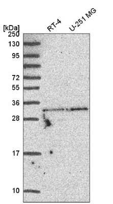 Western Blot: TATDN1 Antibody [NBP2-55666]