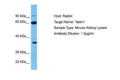 Western Blot: TATDN1 Antibody [NBP2-88411]