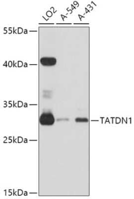 Western Blot: TATDN1 AntibodyAzide and BSA Free [NBP2-93801]