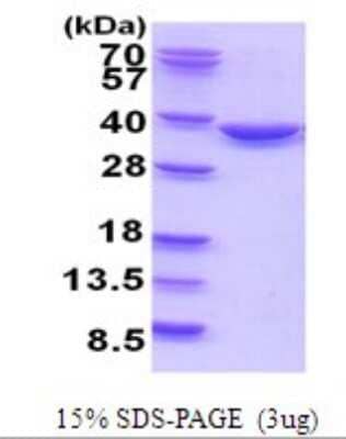 SDS-PAGE: Recombinant Human TATDN1 His Protein [NBP2-51941]