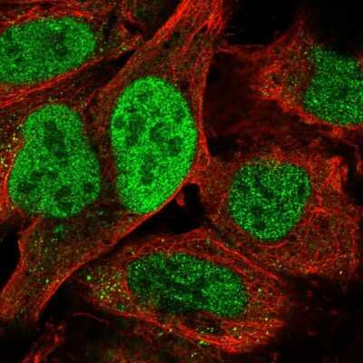 Immunocytochemistry/ Immunofluorescence: TATDN2 Antibody [NBP2-58326]