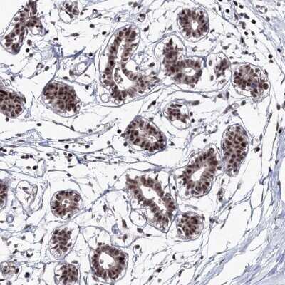 Immunohistochemistry-Paraffin: TATDN2 Antibody [NBP1-93652]