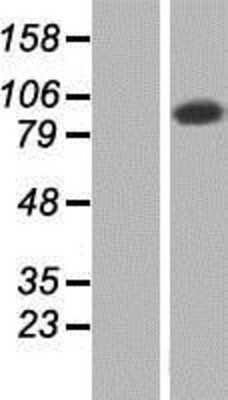 Western Blot: TATDN2 Overexpression Lysate [NBP2-07279]