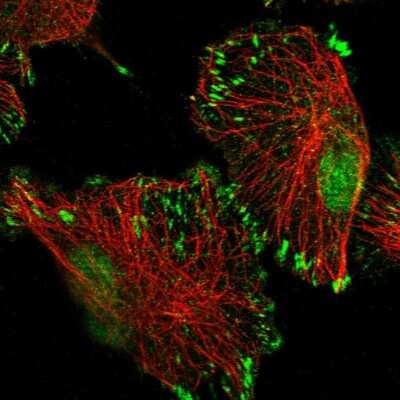 Immunocytochemistry/ Immunofluorescence: TATDN3 Antibody [NBP1-91010]