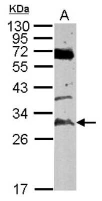 Western Blot: TATDN3 Antibody [NBP2-20573]