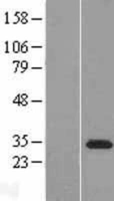 Western Blot: TATDN3 Overexpression Lysate [NBP2-08386]