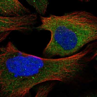 Immunocytochemistry/ Immunofluorescence: TAX1BP1 Antibody [NBP1-86662]