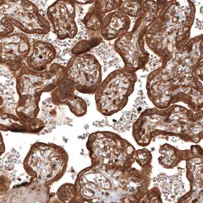Immunohistochemistry-Paraffin: TAX1BP1 Antibody [NBP1-86662]