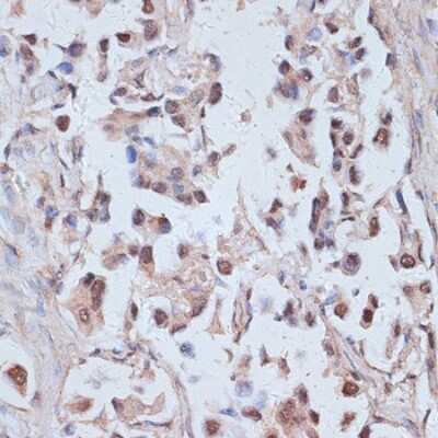 Immunohistochemistry-Paraffin: TAX1BP1 Antibody - Azide and BSA Free [NBP3-05150]