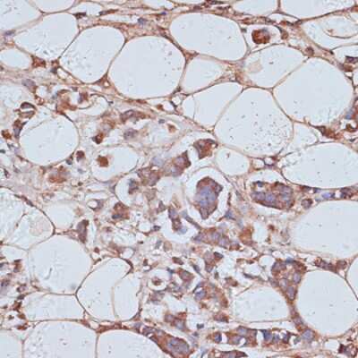 Immunohistochemistry-Paraffin: TAX1BP1 Antibody - Azide and BSA Free [NBP3-05150]