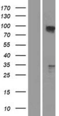 Western Blot: TAX1BP1 Overexpression Lysate [NBP2-04306]