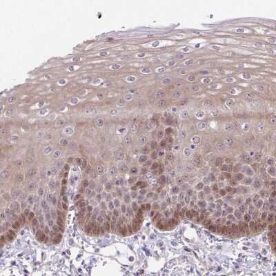Immunohistochemistry-Paraffin: TAX1BP3 Antibody [NBP2-38016]