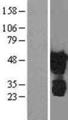 Western Blot: TAZ/WWTR1 Overexpression Lysate [NBL1-17895]