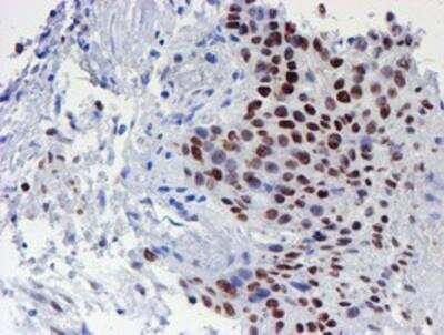 Immunohistochemistry-Paraffin: TAZ/WWTR1 Antibody (OTI1H9) [NBP2-01209]
