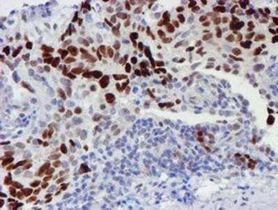 Immunohistochemistry-Paraffin: TAZ/WWTR1 Antibody (OTI1H9) [NBP2-01209]