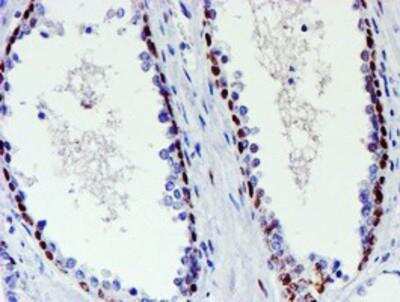 Immunohistochemistry-Paraffin: TAZ/WWTR1 Antibody (OTI1H9) [NBP2-01209]