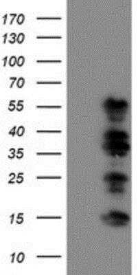 Western Blot: TAZ/WWTR1 Antibody (OTI1H9) [NBP2-01209]