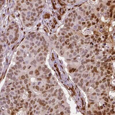 Immunohistochemistry-Paraffin: TAZ/WWTR1 Antibody (CL0371) [NBP2-52926]