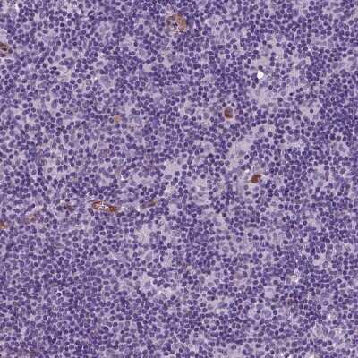 Immunohistochemistry-Paraffin: TAZ/WWTR1 Antibody (CL0371) [NBP2-52926]