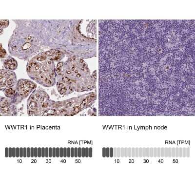 Immunohistochemistry-Paraffin: TAZ/WWTR1 Antibody (CL0371) [NBP2-52926]