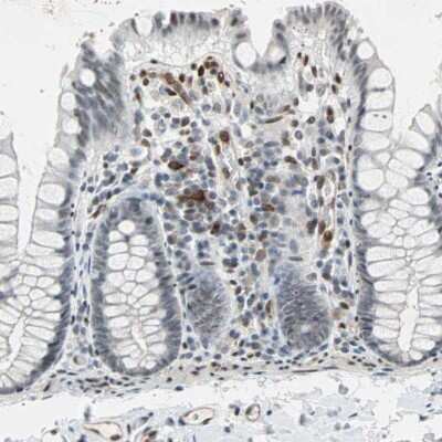 Immunohistochemistry-Paraffin: TAZ/WWTR1 Antibody [NBP1-85067]