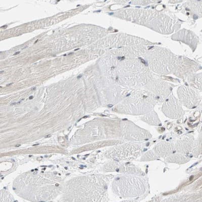Immunohistochemistry-Paraffin: TAZ/WWTR1 Antibody [NBP1-85067]