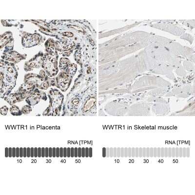 Immunohistochemistry-Paraffin: TAZ/WWTR1 Antibody [NBP1-85067]