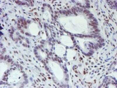 Immunohistochemistry: TAZ/WWTR1 Antibody (OTI1H9) - Azide and BSA Free [NBP2-74449]