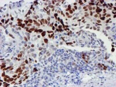 Immunohistochemistry: TAZ/WWTR1 Antibody (OTI1H9) - Azide and BSA Free [NBP2-74449]