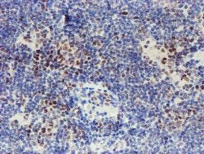 Immunohistochemistry: TAZ/WWTR1 Antibody (OTI1H9) - Azide and BSA Free [NBP2-74449]